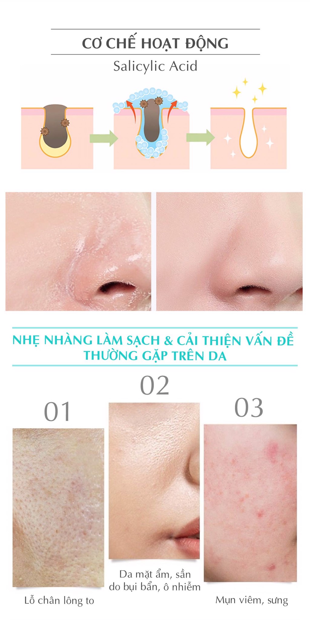sữa rửa mặt ngăn ngừa mụn anti-acne facial cleanser (oil-free salicylic acid) parco 120ml 4
